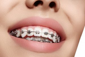 harga behel metal