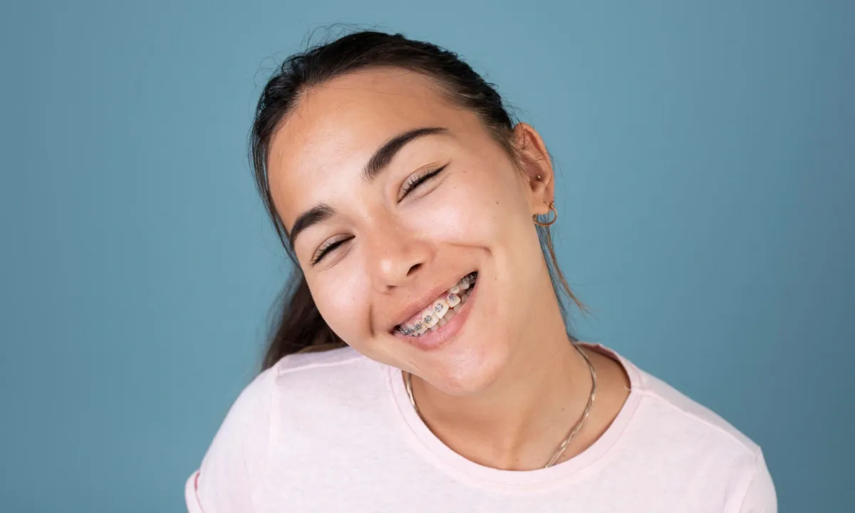 7 Jenis Behel Gigi dan Fungsinya untuk Merapikan Gigi - Edental