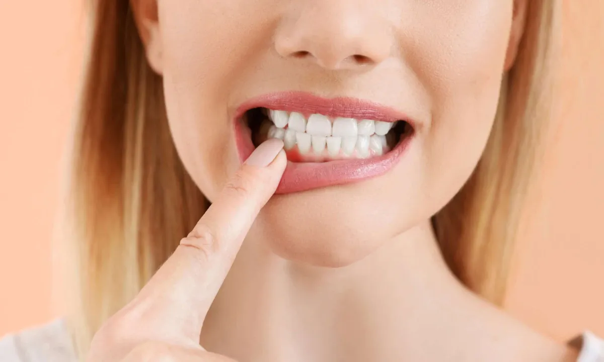 7 Kondisi Gigi yang Tidak Bisa Dibehel atau Tidak Disarankan - Edental