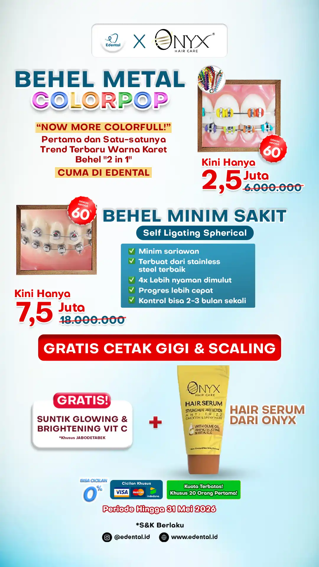 Banner Promo Mei 2026 Tentang Pasang Behel di Edental