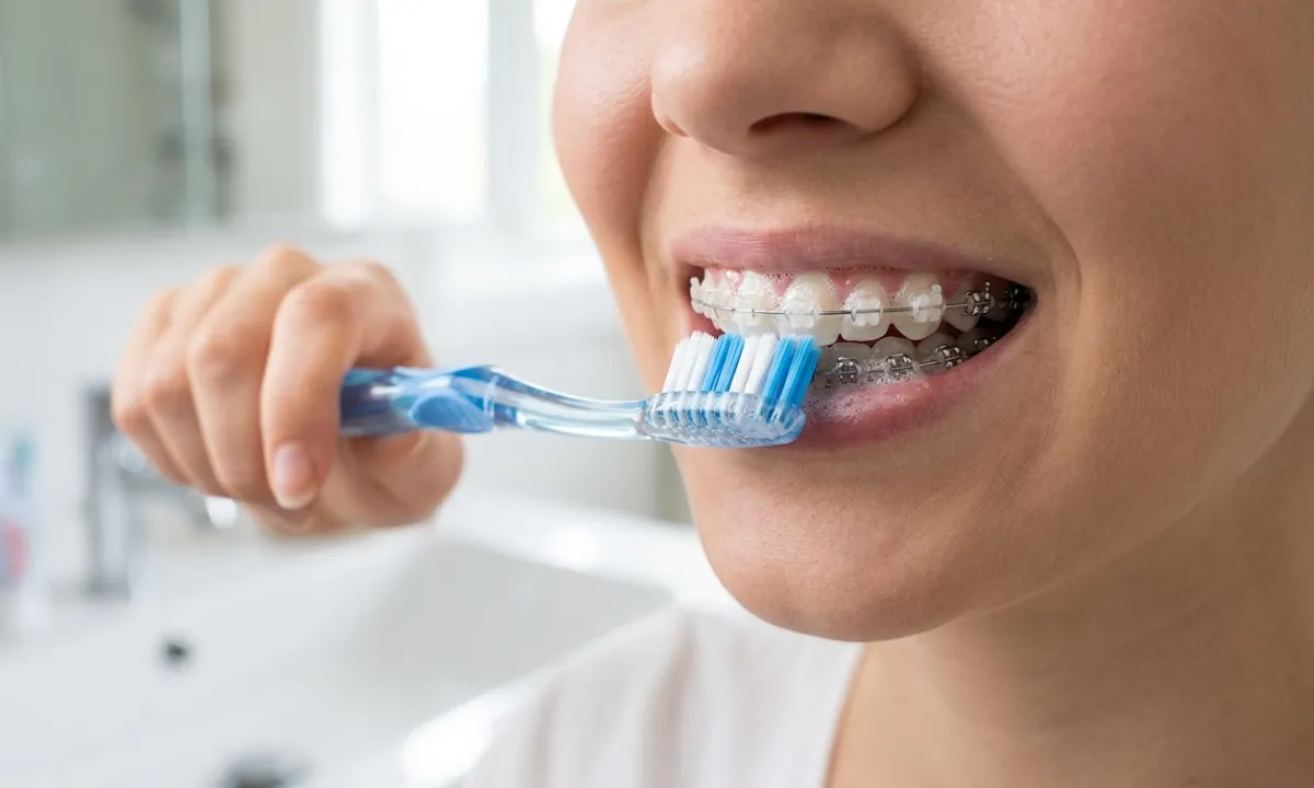 Sikat Gigi Behel Terbaik Rahasia Gigi Bersih & Bebas Plak - Edental