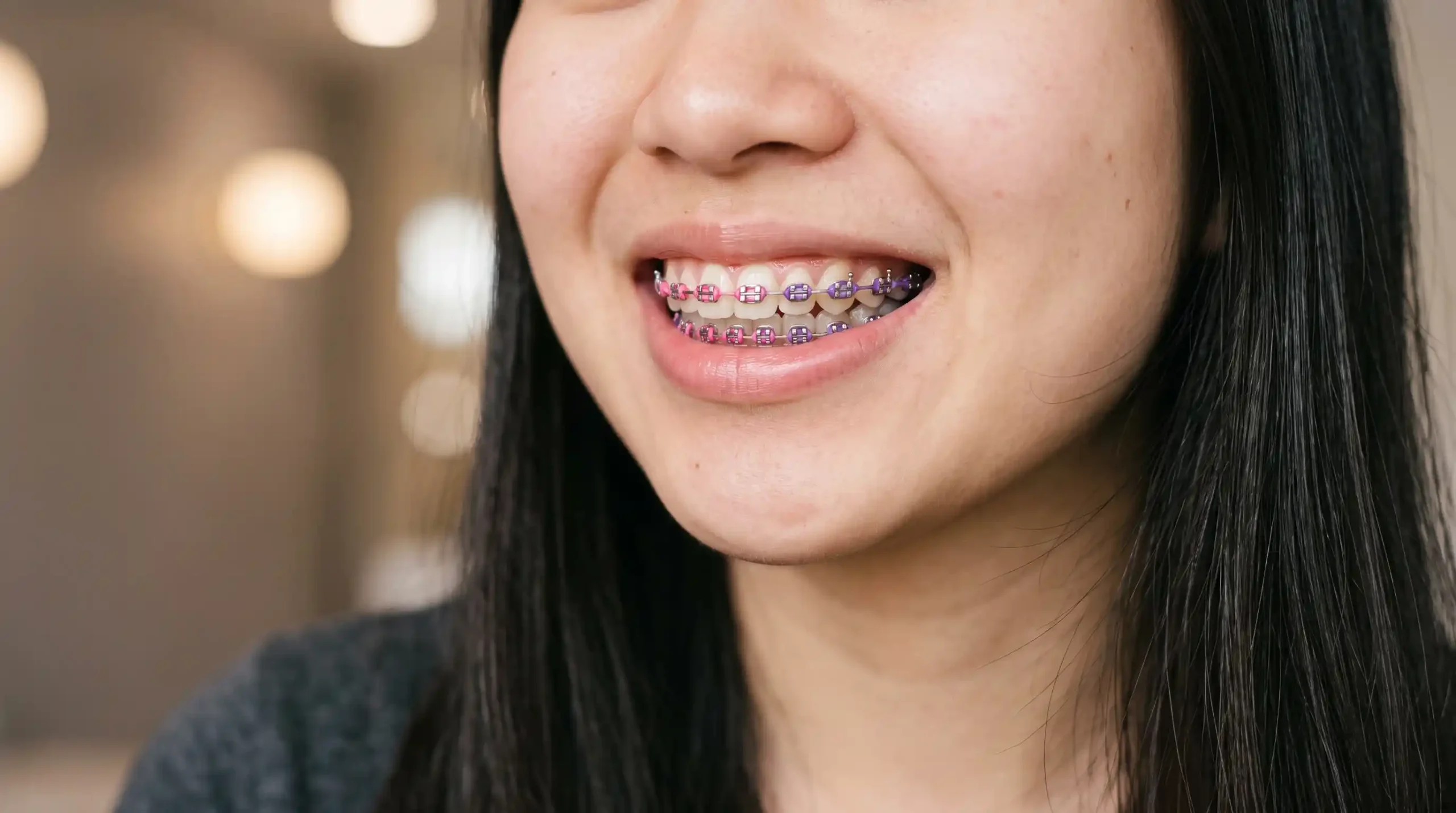 Warna Behel yang Lagi Trend Kombinasi Ombre (Gradasi Warna)