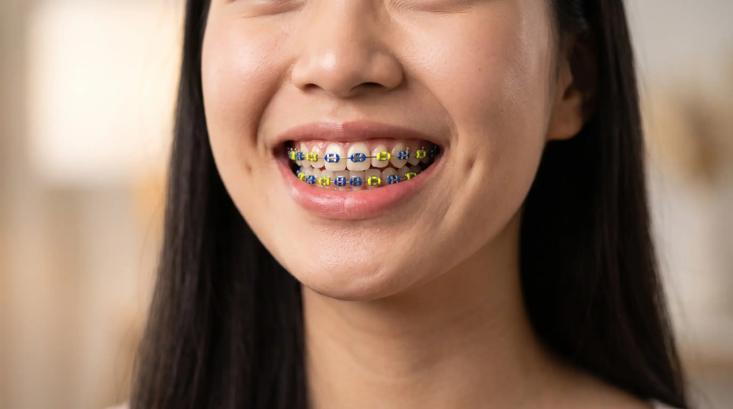 Warna Behel yang Lagi Trend Kombinasi Warna Kontras (Bold Style)