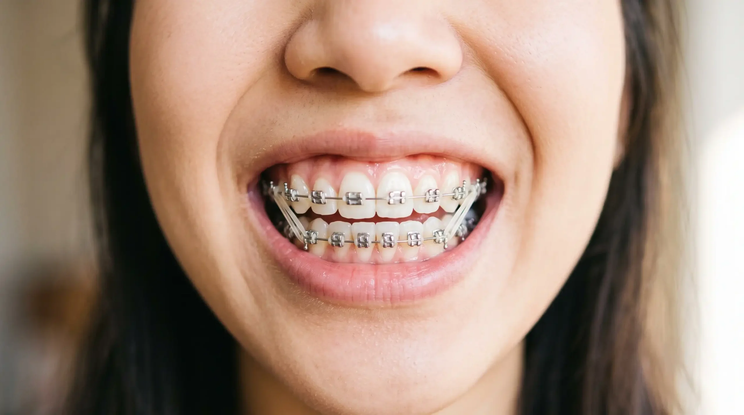 Warna Behel yang Lagi Trend Netral Kalem untuk Gaya Profesional Silver atau Abu-abu Metalik